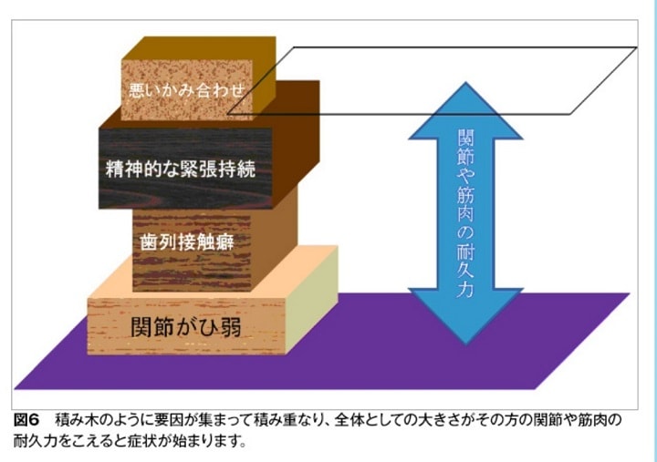 顎関節症の原因