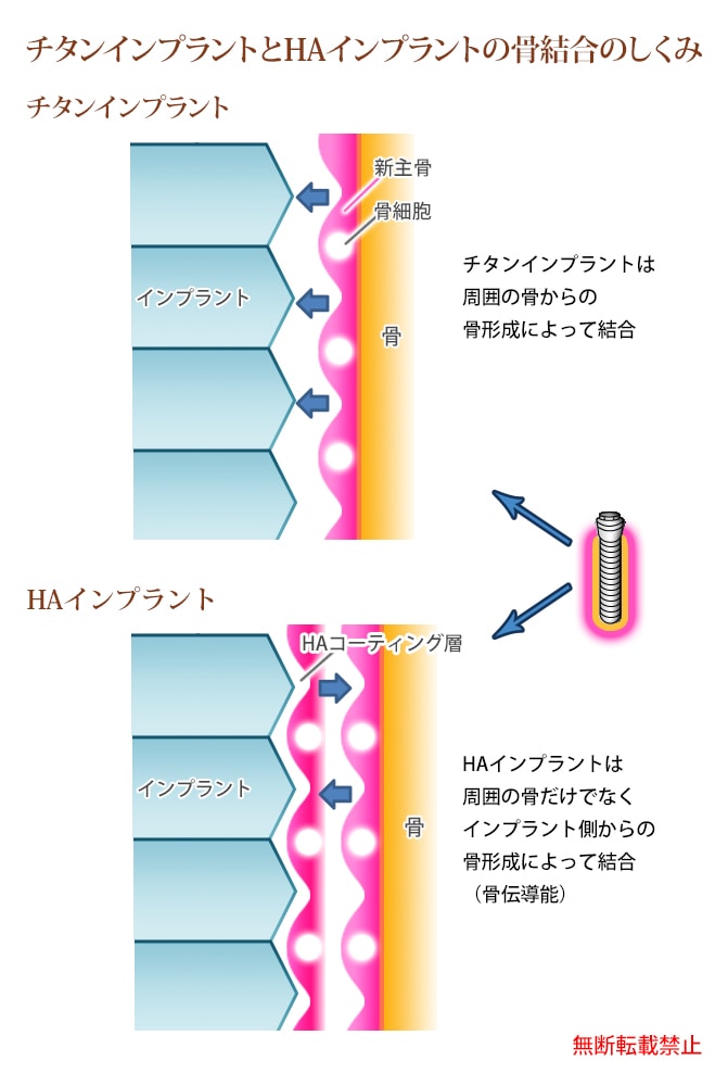 骨伝導能とは