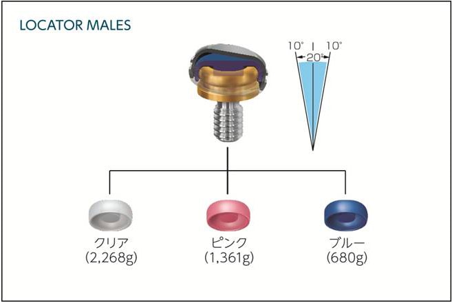 LOCATORオーバーデンチャーの流れ