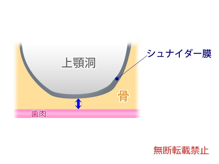 具体的な方法