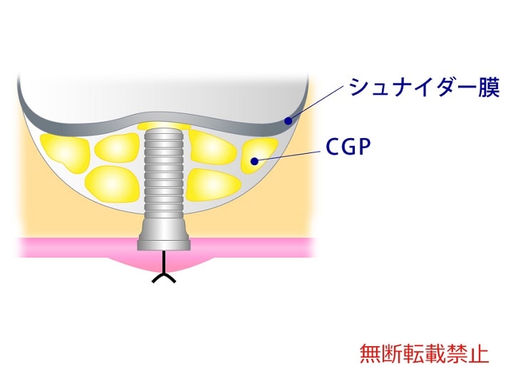 具体的な方法