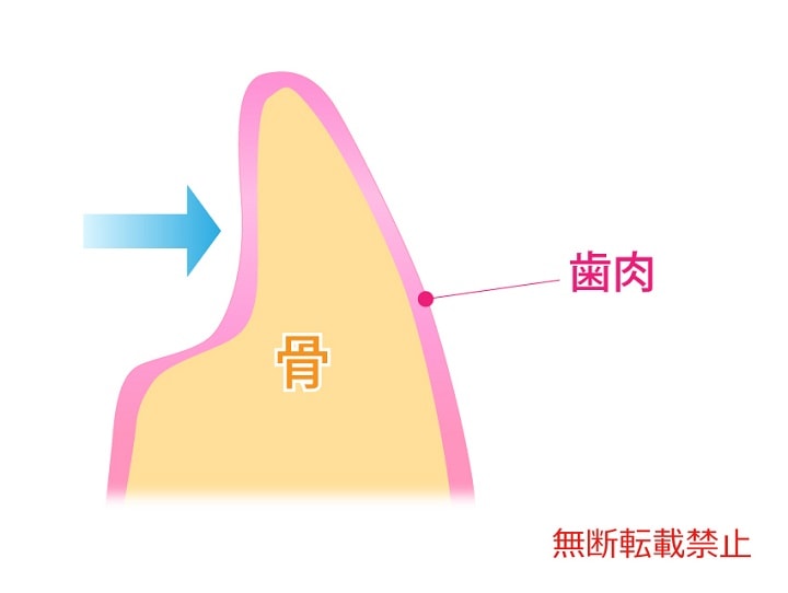 具体的な方法