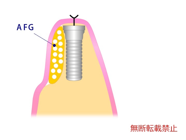 具体的な方法