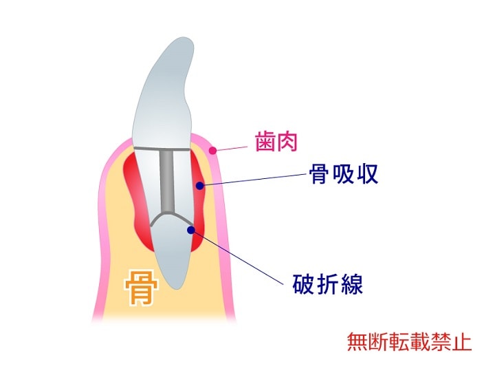 具体的な方法