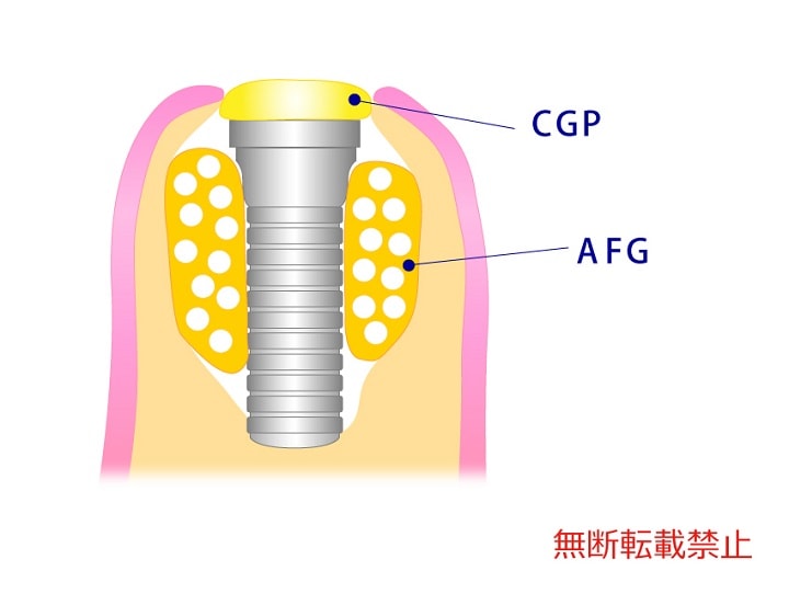 具体的な方法